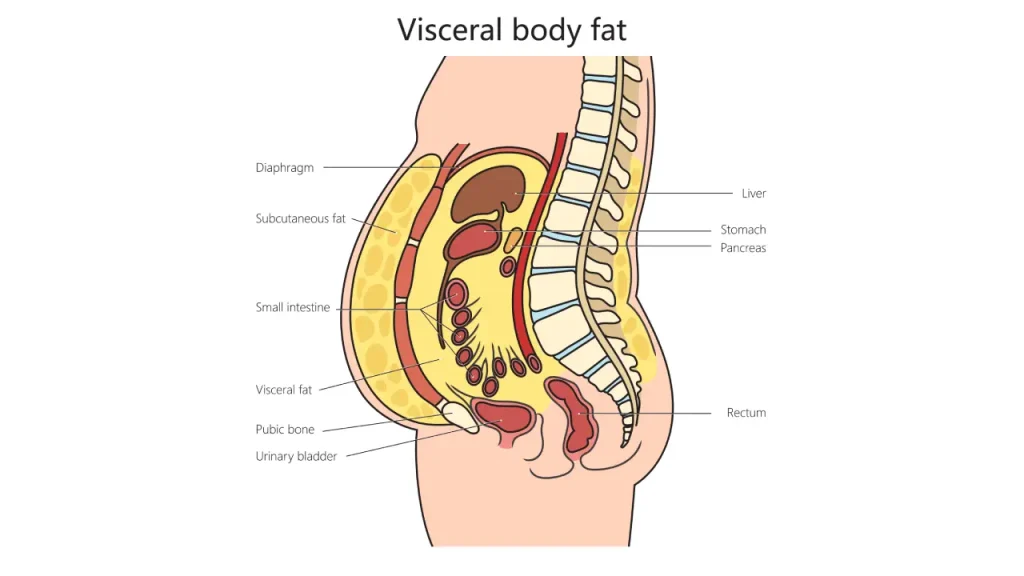 visceral fat